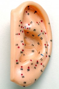 acupunctuur oor